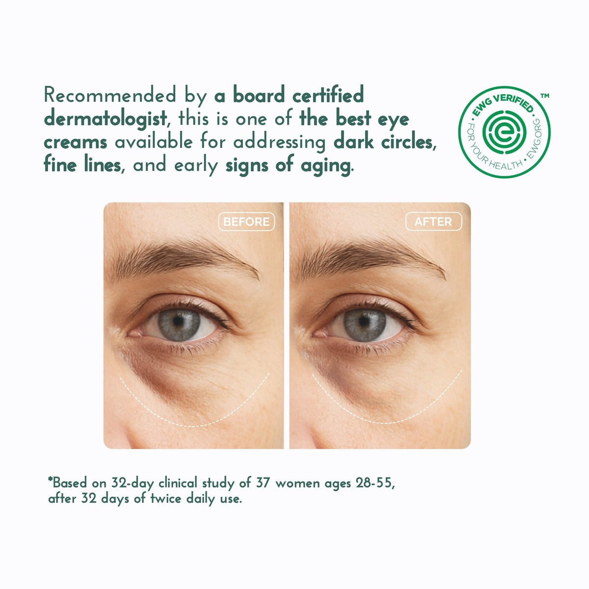 Eye & Neck Cream for Dark Circles and Wrinkles