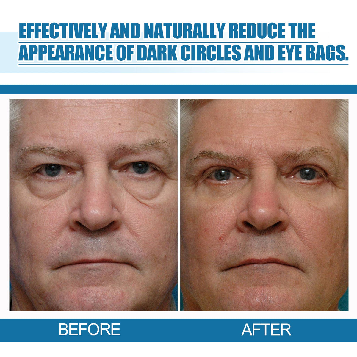 Men's Eye Serum Reduces Fine Lines, Bags, Dark Circles, Moisturizes, Firming, Brightening And Anti - Aging Eye Area - Wrinkle Wizard