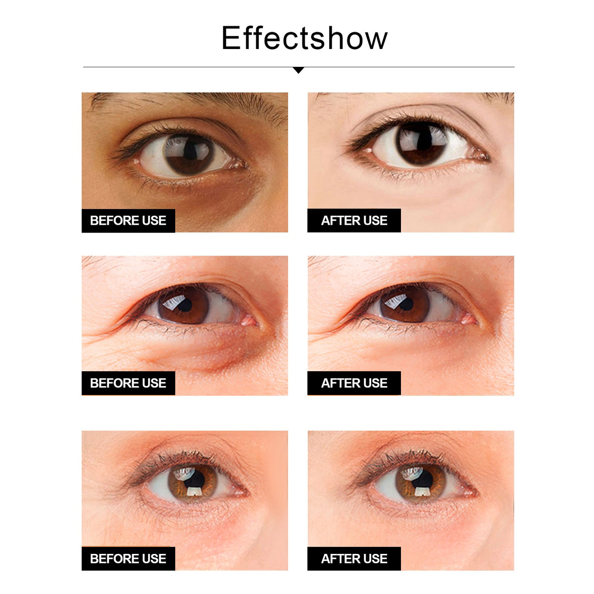 Snake Venom Eye Cream, Firming Eye Bags Hydrating And Reducing Fine Lines Eye Care Eye Cream - Wrinkle Wizard