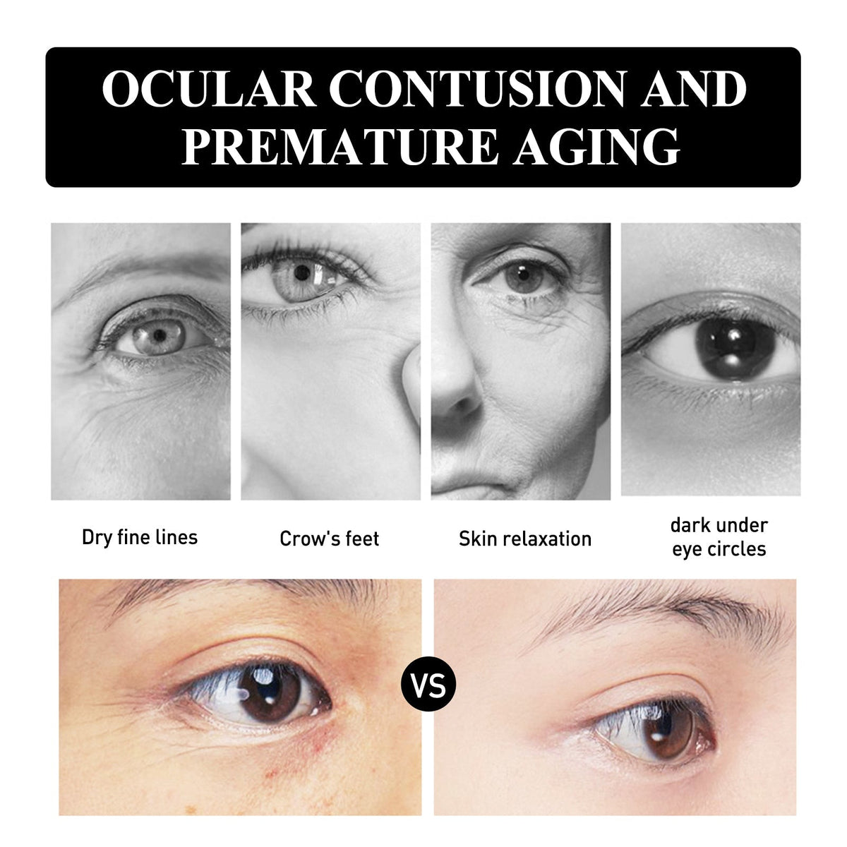 Snake Venom Peptide Moisturizing Eye Cream, Reduce Fine Line Eye Bags Hydrating, Anti - Aging And Anti - Wrinkle Eye Cream - Wrinkle Wizard